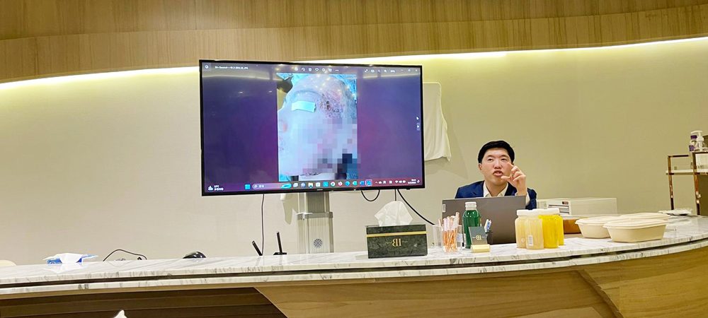 230509-Dr-Alvin-Lee-talked-about-IPL-treatment-on-rosacea,-acne-and-vitiligo-1